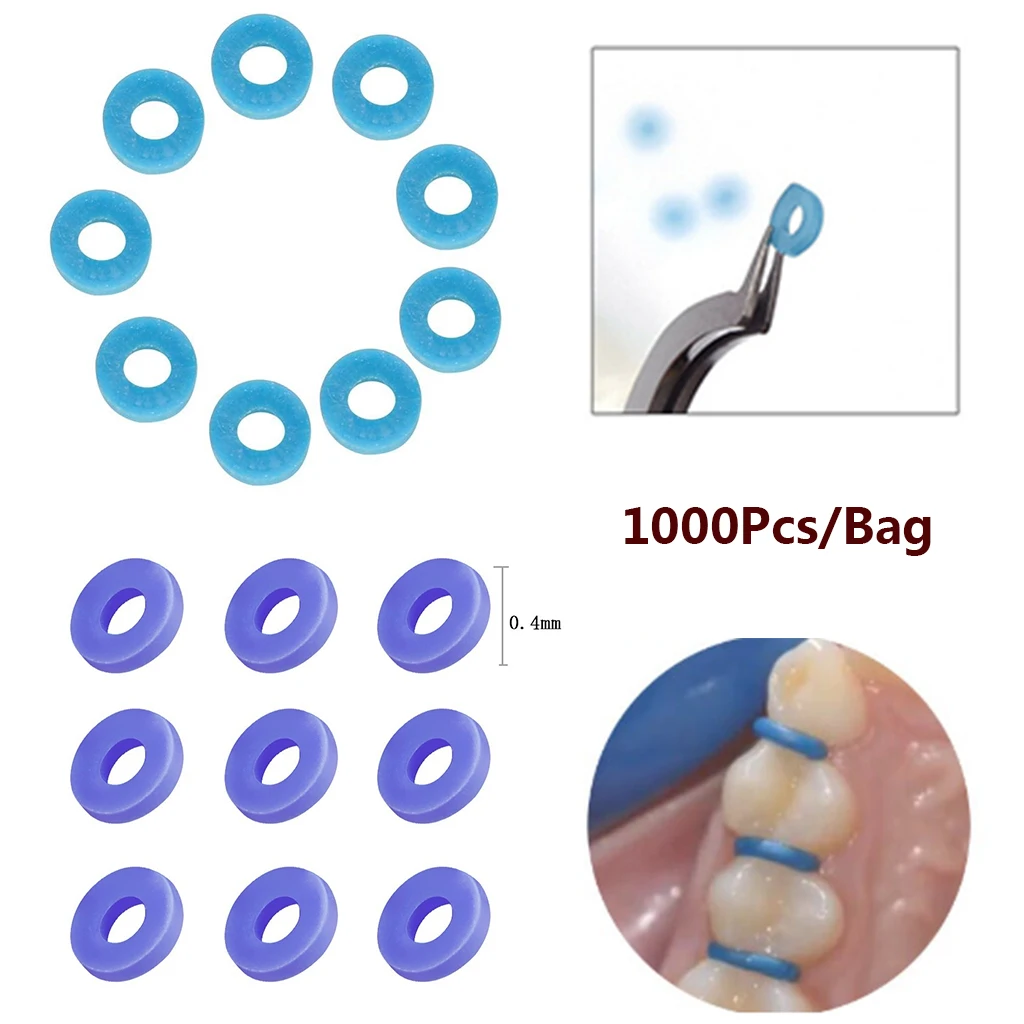 La legatura separata ortodontica del separatore dentale dell'ortesi di Cesoon 1000 pz/pacco lega i materiali blu/viola continui elastici di odontoiatria