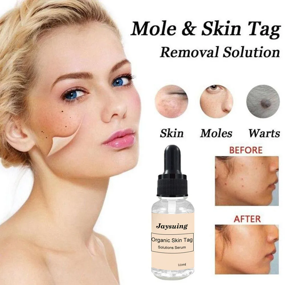 

Non-Trace Removal Moles Potion Blackhead Remover 12 Hours Medical Fast Repair Skin Tag Mole Dark Spot Face Beauty Skin Care Tool