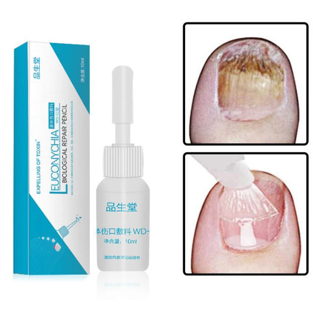 

10ml Nail Fungus Treatment Liquid Remedy Nail Fungus Treatment Feet Care Essence Whitening Toe From Nail Foot Fungus Remove Gel