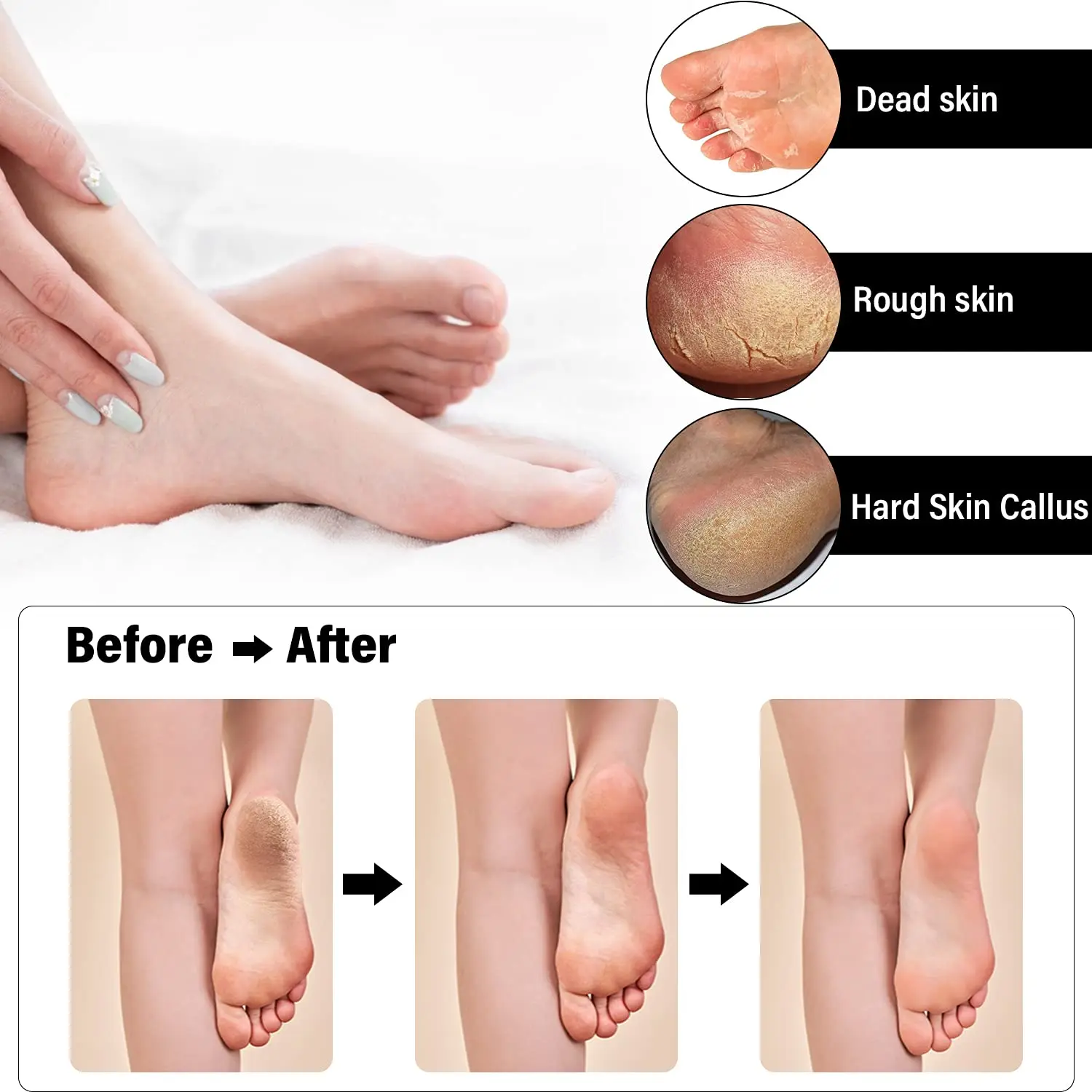 

Electric Foot Callus Remover KitRechargeable Pedicure Tools Foot Care Feet FileRemove Cracked Heels Calluses and Dead Skin