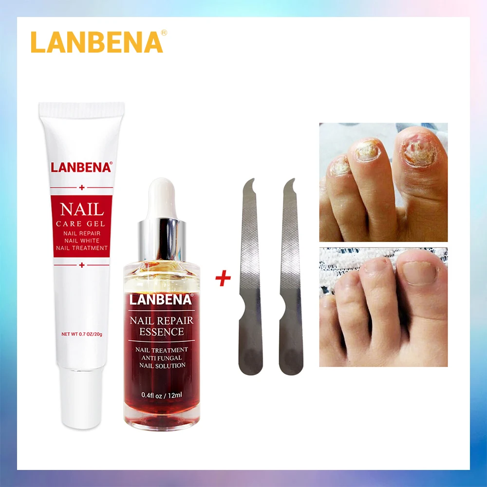 LANBENA гель для ухода за ногтями+ эссенция для восстановления ногтей, сыворотка для лечения Ногтей, удаление онихомикоза, ноготь, питательный уход за руками и ногами, 2 шт