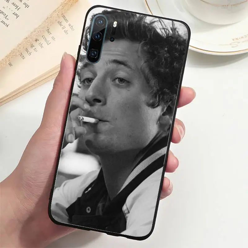 

Lip Gallagher Shameless Phone Case For honor 7 8 9 10 20 30 A X S lite pro PLAY Cover Fundas Coque