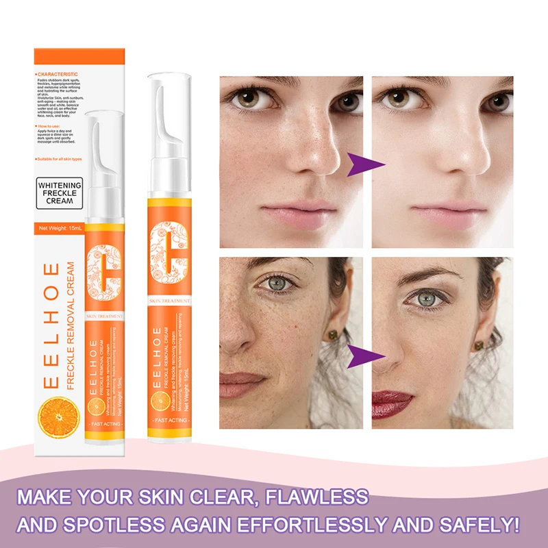 

EELHOE Vitamin C Whitening Cream Instant Blemish Removal Gel Freckle Pigmented Melanin Spots Remove Pen Brighten Moisturizer