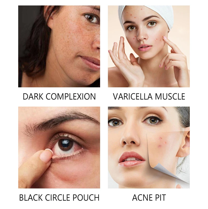 Аппарат Photon PDT для отбеливания и светильник моложения кожи лица Led лечения акне 7