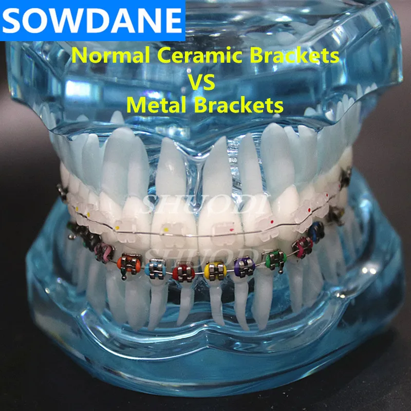 Стоматологическая Ортодонтическая модель связи пациента 2 вида кронштейнов с