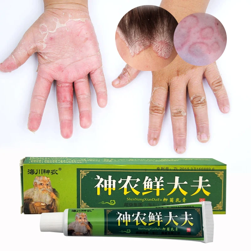 Psoriasi Eczma крем спрей Хорошо работает против проблем с кожей|cream for skin|cream psoriasiscream