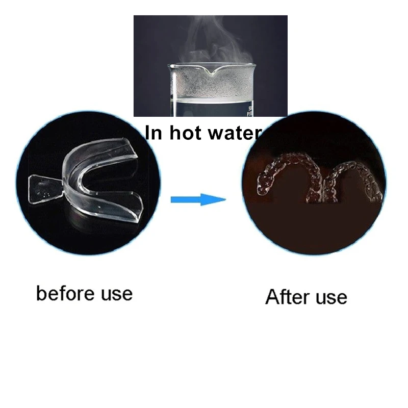 2 шт. домашнее отбеливание зубов Зуб лоток аксессуары термопластичный