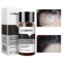 hair care quick hair growth essential oil anti hair loss liquid anti dandruff oil control polygonum multiflorum scalp care 20ml