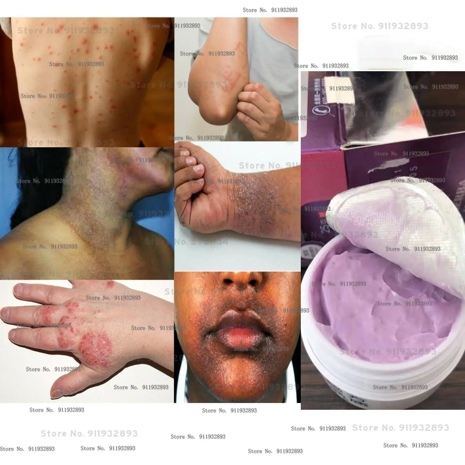 

Skin Repair Herbal Cream, Eczema, Skin Rashes, Dry Skin, Damaged Skin