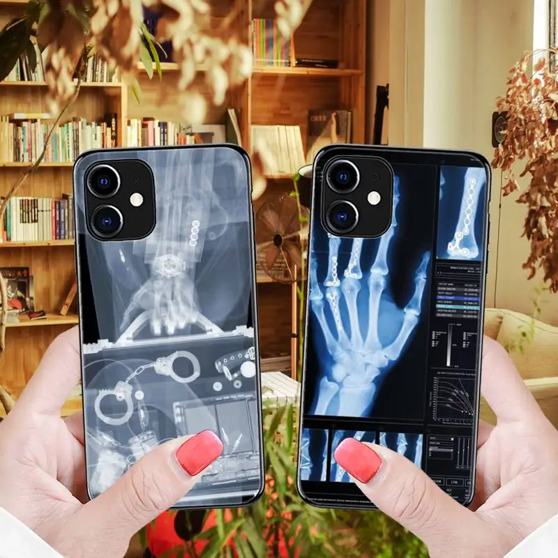 

Radiological human organs Phone Cases for iPhone 12 8 7 6 6S Plus X 5S SE 2020 XR 11 12 Pro mini pro XS MAX cover