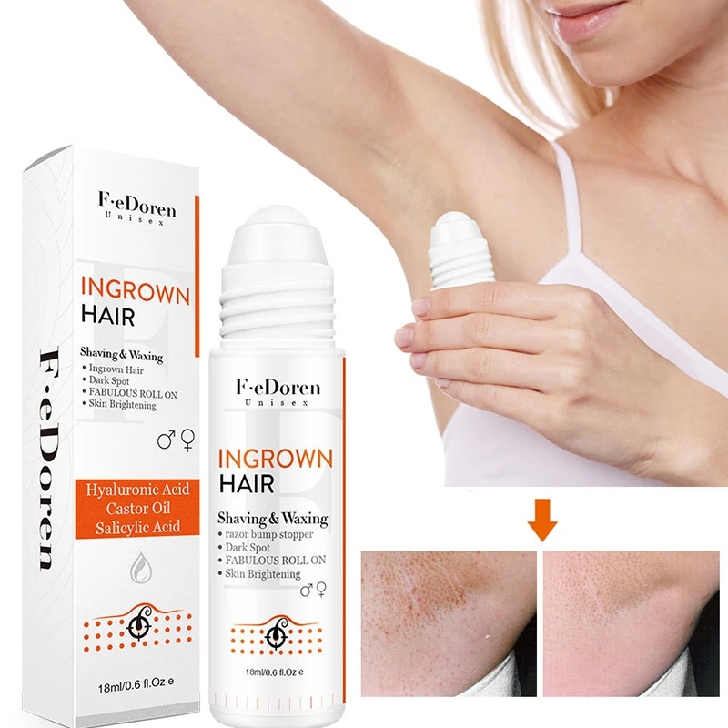 Вросшие волосы для мужчин восстанавливающая сыворотка после бритья темных точек