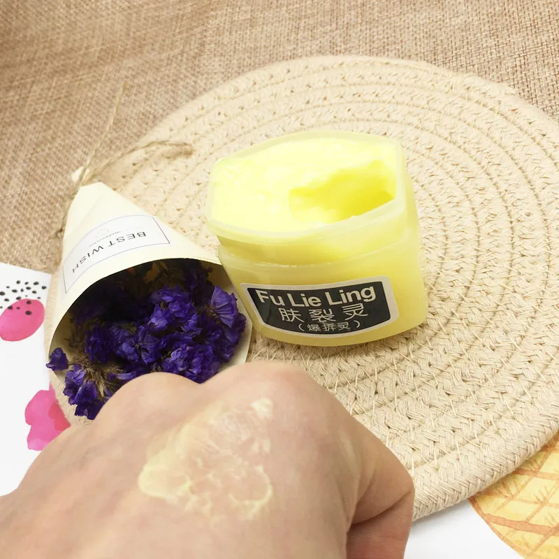 

Natural Cure Face Cream Prevent Skin From Crowfoot Cracks Moisturize Face Skin Frost Crack Prevention For The Winter Dry Skin