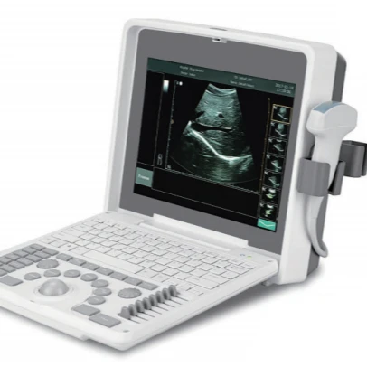 

Factory price digital b ultrasound machine usg portable laptop diagnostic medical scanner human ultrasound system price