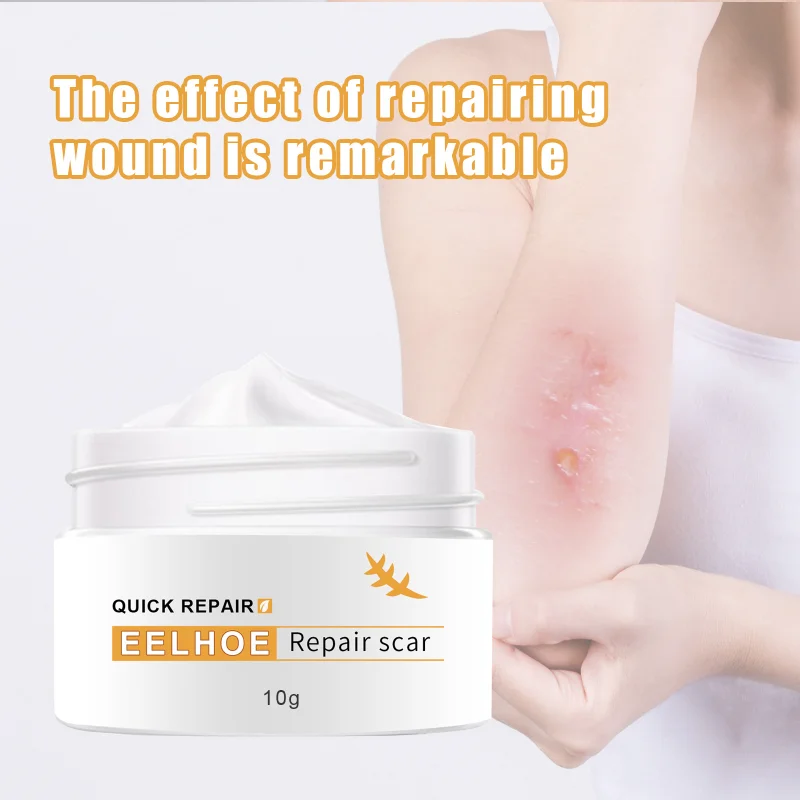 

Scar Repair Cream Stretch Marks Skin Trauma Ointment Burning and Fading Acne Scars Whitening Moisturizing Body Skin Care