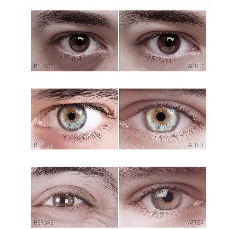 

Men's eye cream Lightens fine lines Removes dark circles the nigh skin and Day night around the up Stays the artifact Firms R1O2