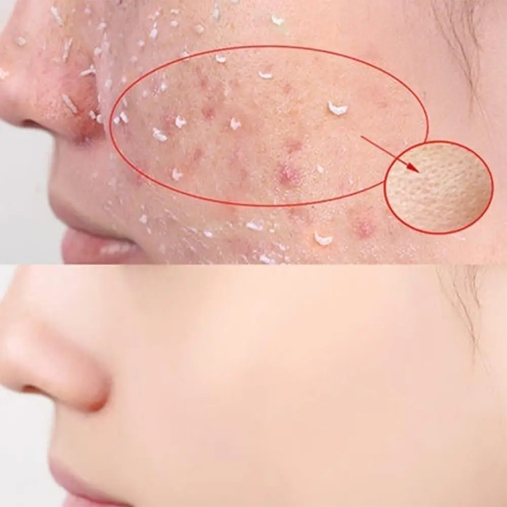 Отшелушивающий скраб для лица пилинг гель увлажняющий отбеливающий витамин C и