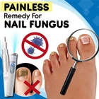 Ручка для ногтей, 1 шт., противогрибковая Ручка для домашнего лечения Ногтей на пальцах ног, безболезненное удаление онихомикоза, противогрибковая ручка, Уход за ногтями, инструменты для ремонта ногтей