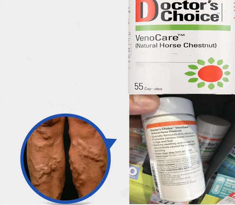 

Improved varicose veins function plant horse chestnut extract