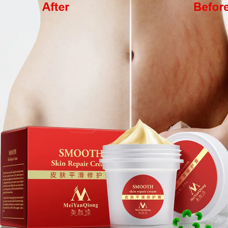 

1pc Stretch Marks Removal Cream Skin Repair Cream Body Cream Natural Essence Repair Cream For Pregnancy Maquiagem Makeup