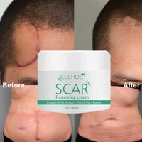 removal scar cream face pimples scar stretch marks removal acne treatment cream skin moisturizing cream skin care product