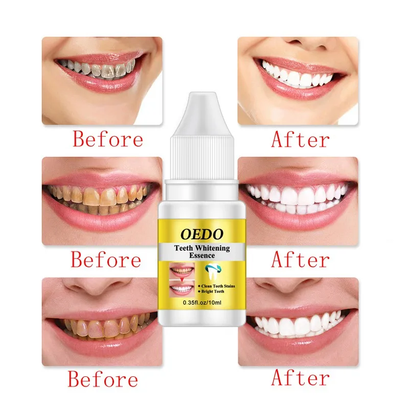 2018 Teeth Whitening Essence Oral Hygiene Cleaning Serum White Gel Care Remove smoke stains and Plaque Perfect Smile 10ml | Красота и
