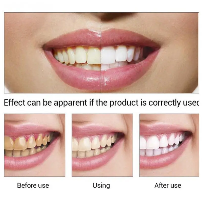 Отбеливание гигиены полости рта Очищающая Сыворотка для зубов удаляет пятна