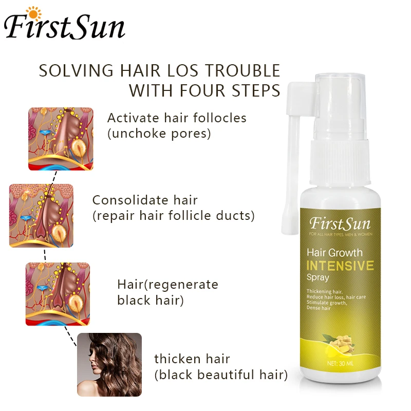 Набор для ухода за волосами спрей роста волос имбирный шампунь против выпадения