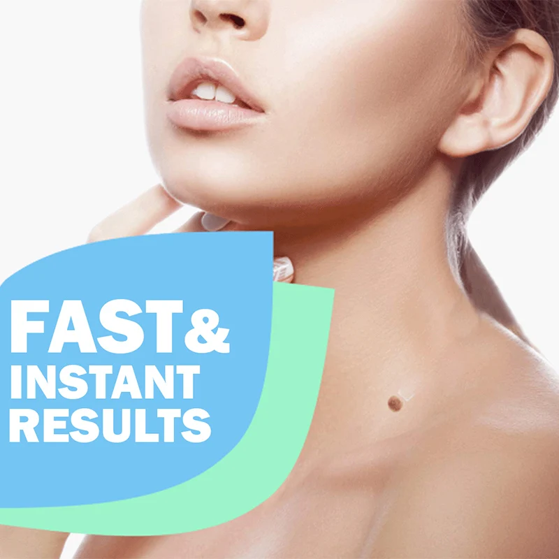

Tags and Moles Remover Removes Skin Tag and Moles Gently Rejuvenate Skin J9