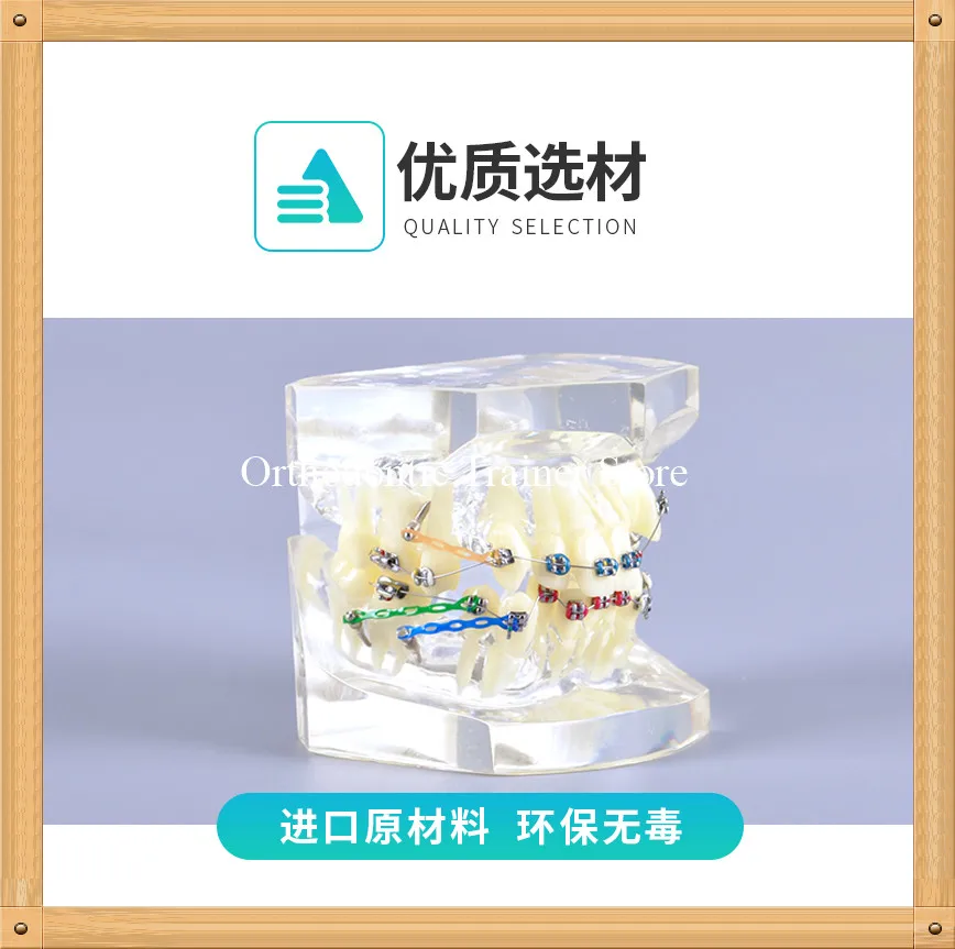 Стоматологическая Ортодонтическая модель для коррекции неисправностей|Брекеты