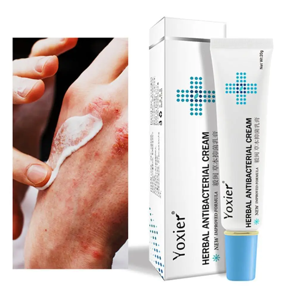 

Yoxier 20g Herbal Antibacterial Cream Psoriasis Cream Anti-itch Relief Eczema Skin Rash Urticaria Desquamation Treatment 3/5/10