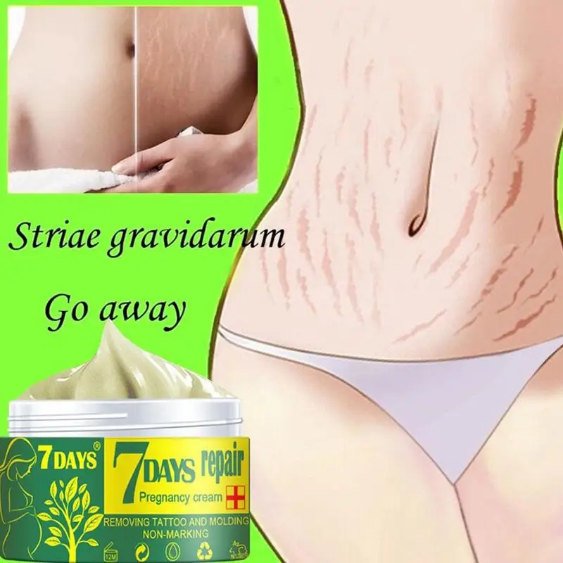 Removal Stretch Mark Cream Repair Abdomen Scar Acne Cell Regeneration Beauty Skin Promote Cosmetics L3D6 |