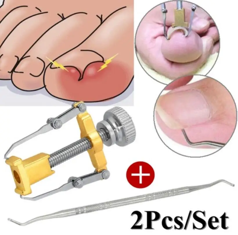 2pcs set B Для вросших ногтей, педикюра, инструмент для ухода за ногами, инструмент для коррекции ногтей, кусачки для коррекции ногтей, для ортопедического акрокса, средство для удаления омертвевшей кожи, Podiatry - Цвет: 2pcs set B