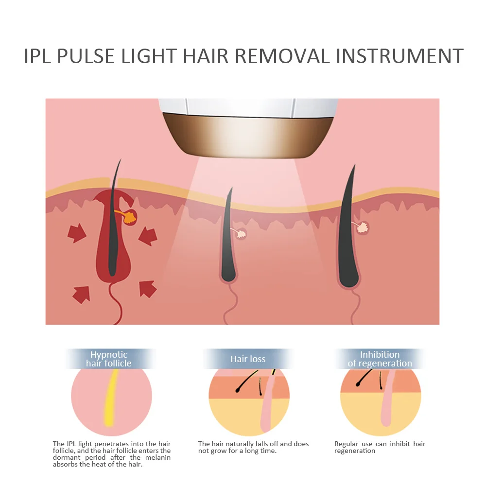 IPL лазерная машина для удаления волос лазерный эпилятор для удаления волос постоянный Триммер бикини Электрический лазерный депилятор для женщин