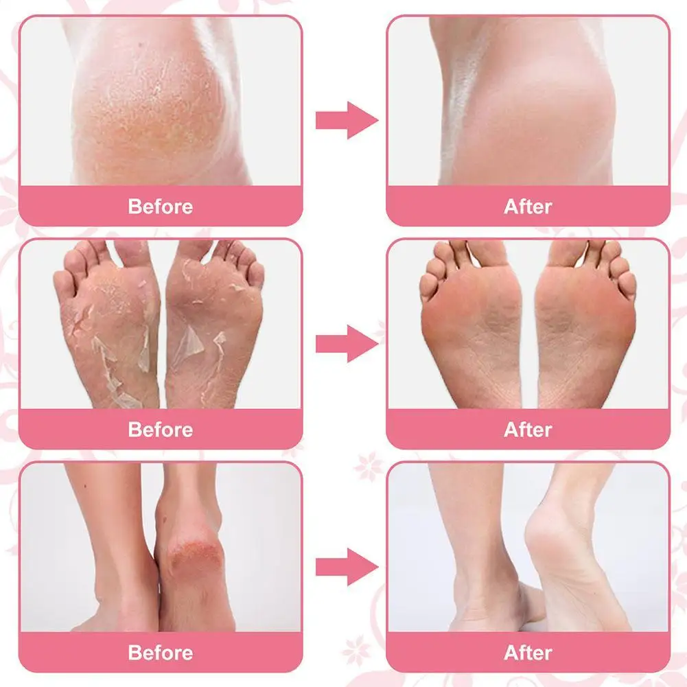 

Hot Peeling Foot Mask Lavender Rose Care Selling Calluses Dead Skin Cuticle Foot Mask Cover Voetverzorging Tool