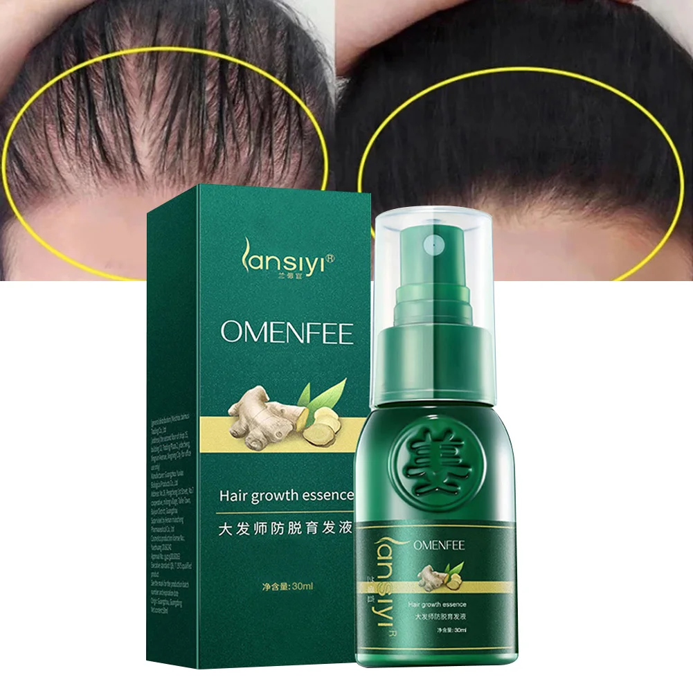 Сыворотка Имбирная для роста волос 7 дней | Красота и здоровье