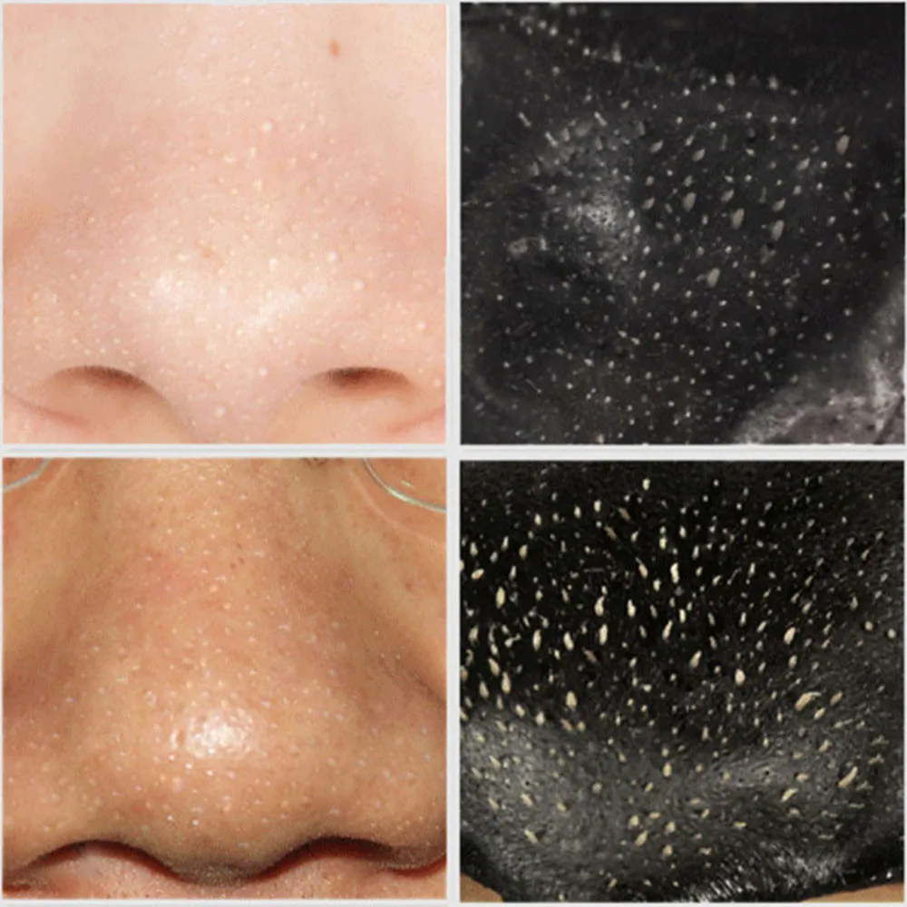 Маска для удаления черных точек с бамбуковым древесным углем черной грязи