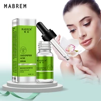 acne treatment face serum long lasting natural facial essence oil control ance moisturizing anti aging anti wrinkle face care