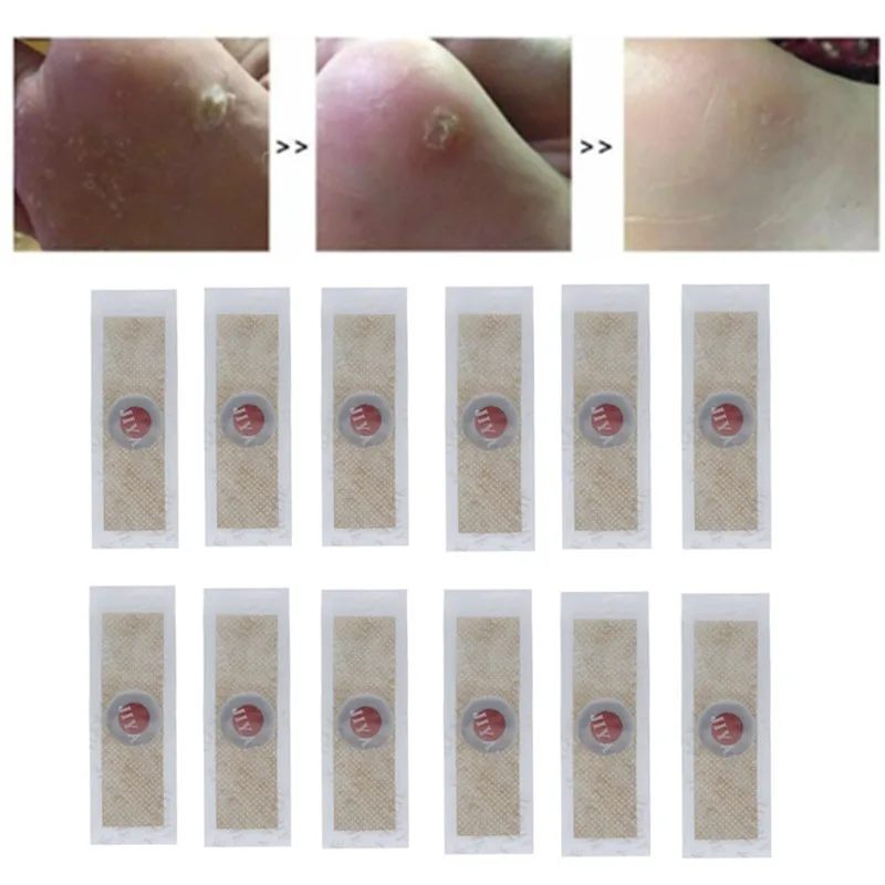 12 шт. медицинский пластырь для ног кукурузы удаления бородавки шип Пластырь от