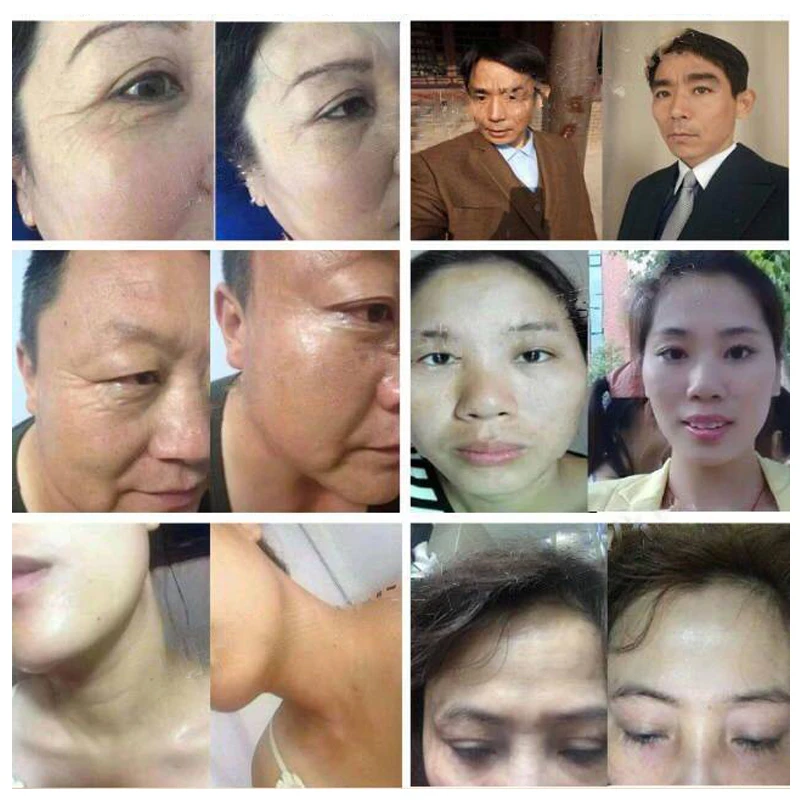 

Snake Venon Serum Wrinkle Fine Lines Removal Collagen Essence Whitening Tighten Face Serum Anti Aging Skin Care Korean Cosmetics