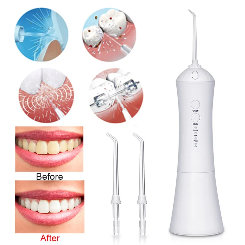 

Intelligent Oral Irrigator USB Rechargeable Water Flosser Portable Dental Water Jet Waterproof Teeth Cleaner 230ML Water Tank