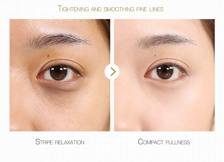 OEM хумаи увлажняющий антивозрастной против морщин устройство для удаления