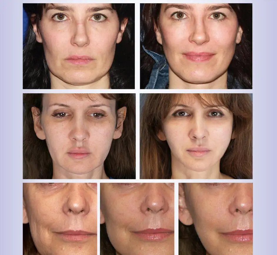 Антивозрастное эфирное масло для лица быстрое бритье эсенция удаление морщин