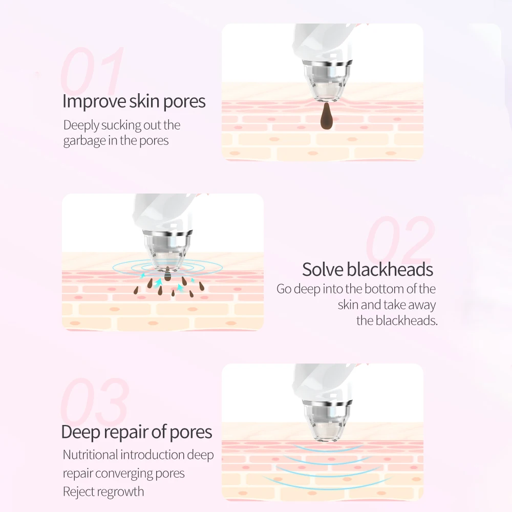 Электрический инструмент для удаления чёрных точек ЖК дисплей Дисплей WI FI