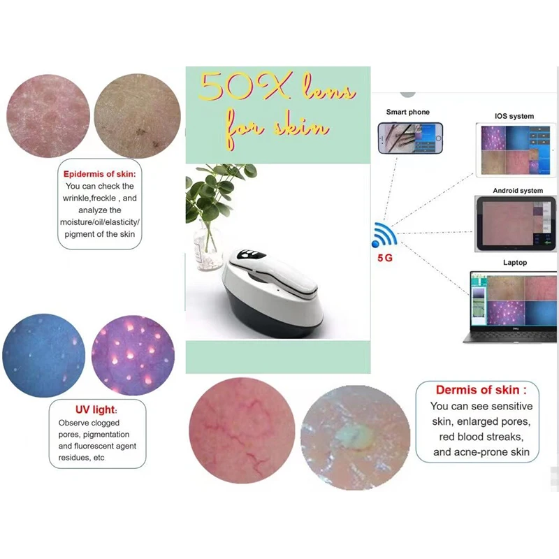 TDOUBEAUTY BM-999 Wireless WI-FI Skin&ampScalp Auto Analyzer Skin Cream For Cuts &amp Burns Charging Technology (Pink) | Красота и