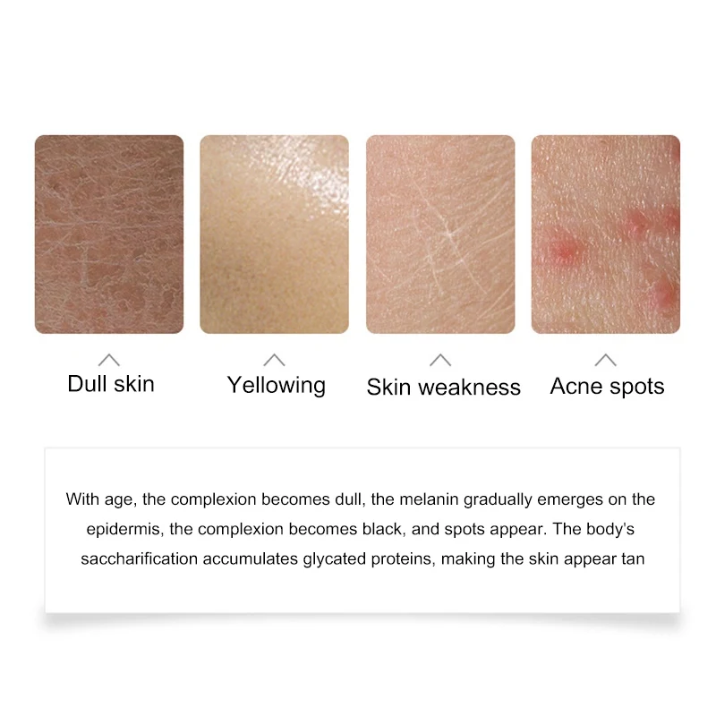 Эссенция Niacinamide жидкая осветляет кожу увлажняющий уход за кожей лица с