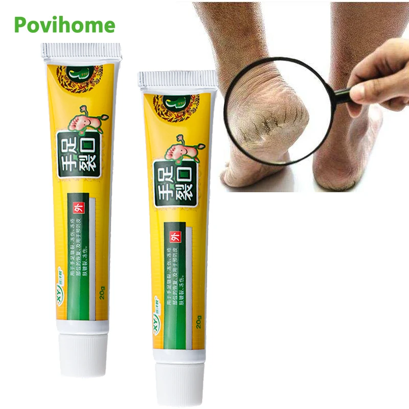 

Крем для ног с трещинами для рук и ног, Антивозрастная восстанавливающая мазь для пятки с трещинами, удаление омертвевшей кожи, уход за коже...