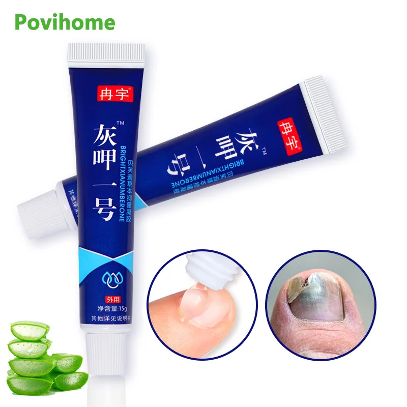 

1Pcs 15g Nail Repair Ointment For Anti Infection Fungus Onychomycosis Paronychia Treatment Cream Aloe Extract Medical Plaster