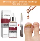 Жидкий гель LANBENA для восстановления ногтей, уход за паронихией и онихомикозом, Лечение грибка ногтей, инструменты для дизайна ногтей ежедневно, TSLM1