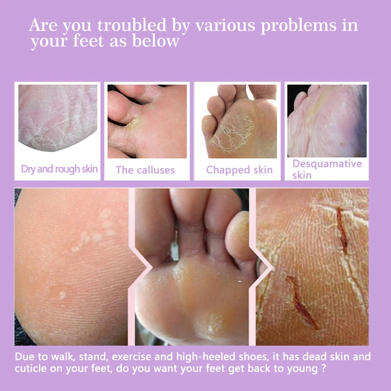 9pair Foot Peeling Mask Renewal for Legs Remove Dead Skin Smooth Exfoliating Socks Care Pedicure | Красота и здоровье