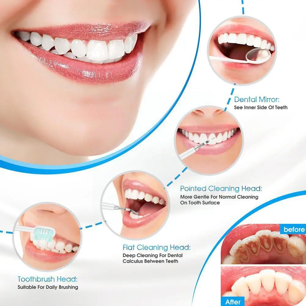 

Sonic Electric Toothbrushes Tartar Remover Teeth Whitening Scaler Kid Stains For Adult Remover Care Teeth Tartar J4H5